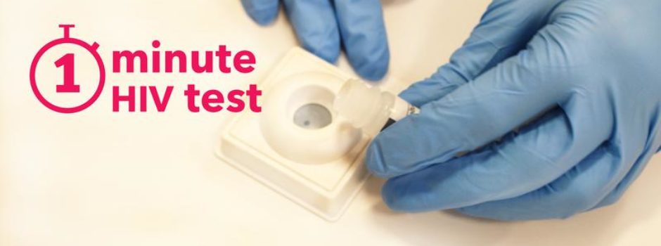 hiv testing